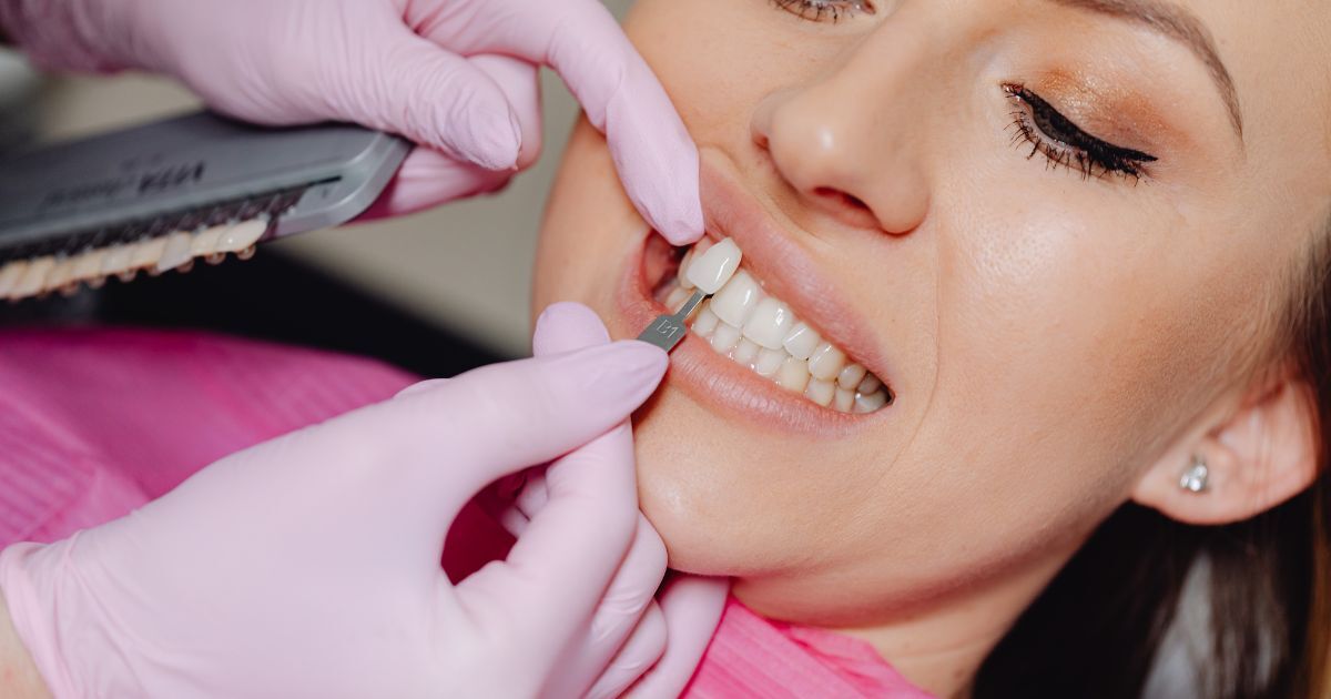 Rehabilitación estética: más allá de la sonrisa, recupera la confianza