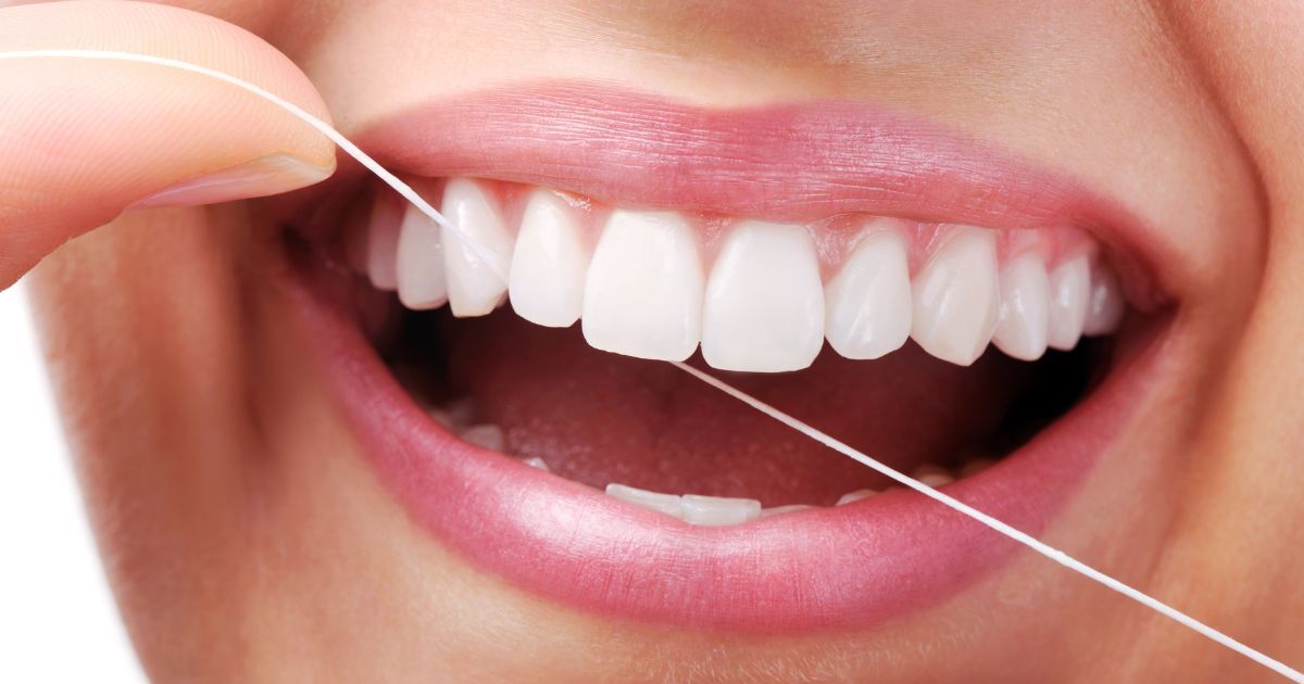 Periodoncia: cómo prevenir la pérdida de piezas dentales